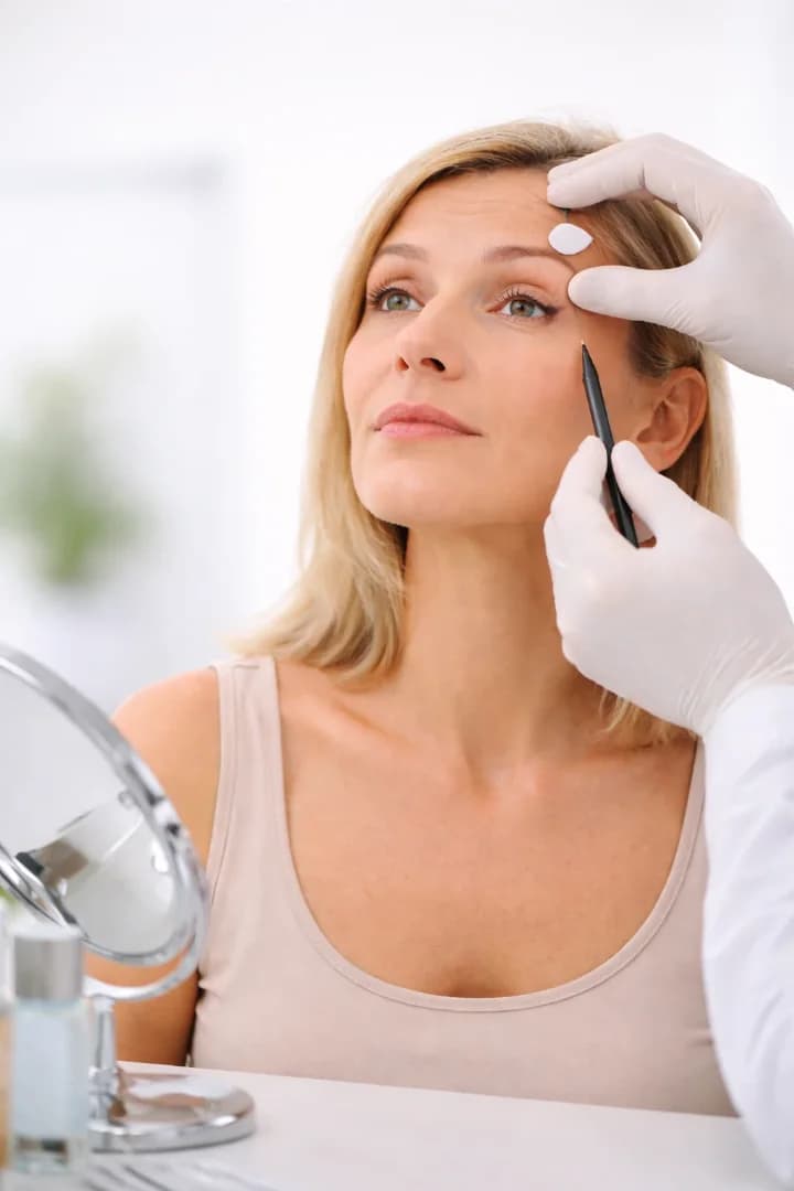 Cuidados antes de una blefaroplastia: prepárate para una recuperación exitosa