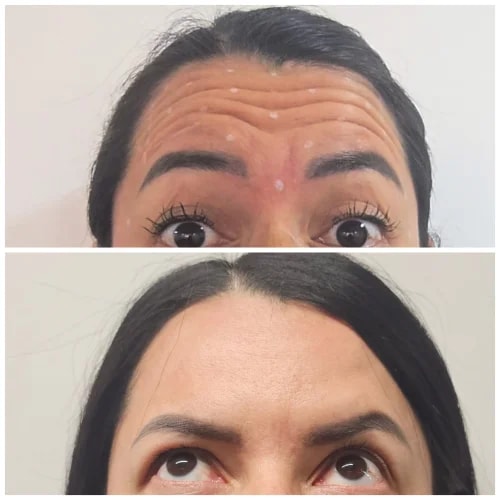 Resultado de Medicina Estética Facial 1