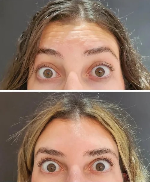 Resultado de Medicina Estética Facial 2